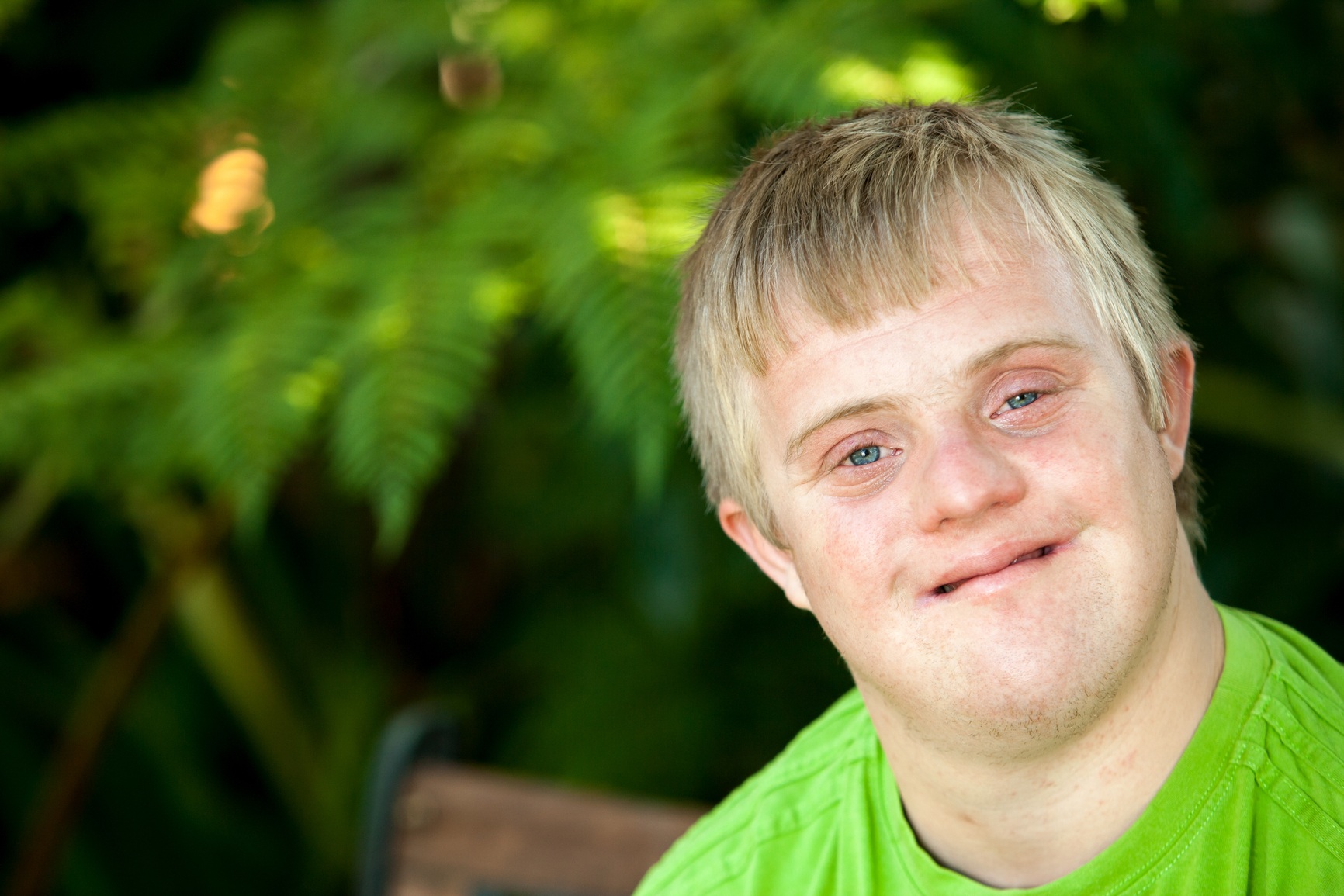 What Is The Average Down Syndrome